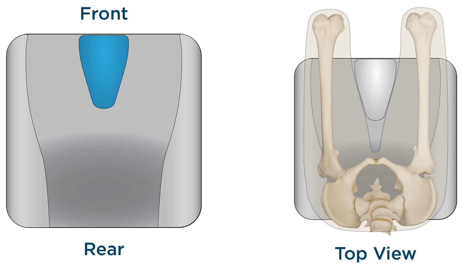 Contoured Cushion Components